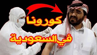 السعودية أول حالة مسجلة لفيروس كورونا