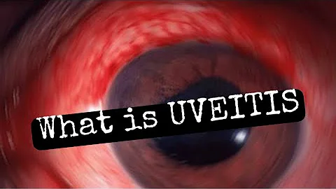 What is Uveitis? Types of uveitis explained