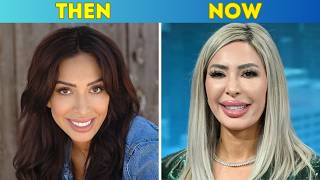 You Won't Believe These Stars After Plastic Surgery! 😱 (2026 Evolution)