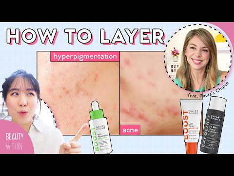 How to Reduce Acne, Hyperpigmentation & Fine Lines /Wrinkles ft. Paula's Choice