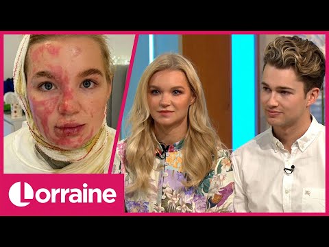 AJ Pritchard's Girlfriend Abbie Talks About Suffering 3rd Degree Burns After Video Went Wrong | LK