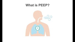 How to use PEEP in ARDS
