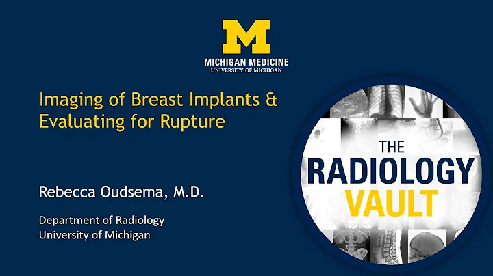 Breast Implant Rupture: MRI & Ultrasound Evaluatione