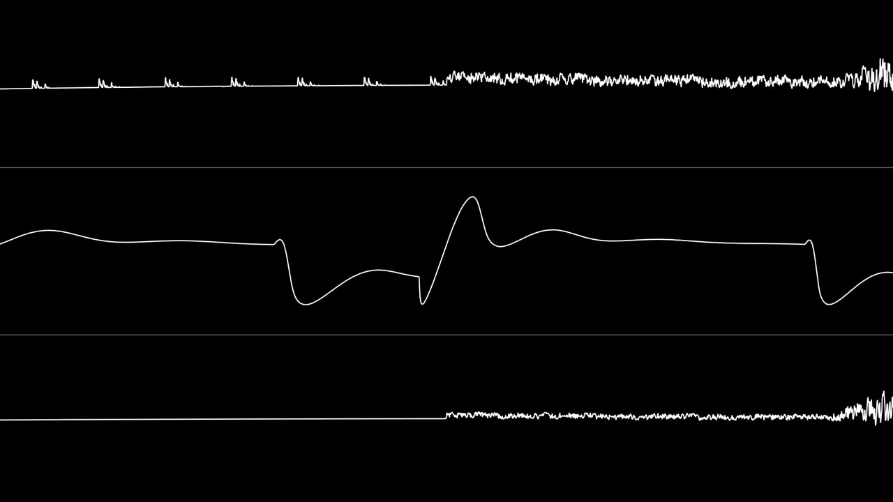 Falco Paul - "Spijkerhoek 3 (C64)" [Oscilloscope View]