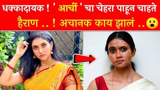 धक्कादायक 'आर्ची ' चा चेहरा पाहून चाहते हैराण  अचानक काय झालं Rinku rajguru Viral social media post