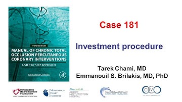 Case 181: Manual of CTO PCI - Investment procedure