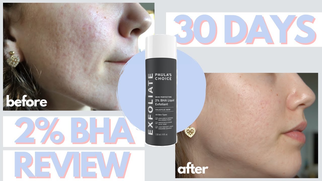 Paula's Choice Skin Perfecting 2% BHA Liquid Exfoliant Serum Uses Benefits and Symptoms Side Effects