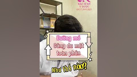 Đường mổ căng da mặt toàn phần như thế nào?