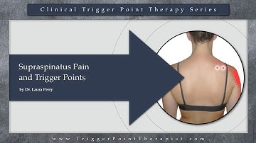 Supraspinatus Pain and Trigger Points