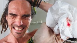 ALS ICE BUCKET FAIL