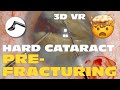 3d phaco clip 164  hard cataract pre fracturing vr headset version