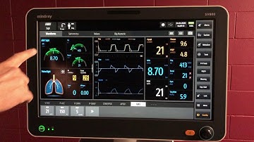 Mindray SV800 Auto mode AMV: Adaptive Minute Ventilation