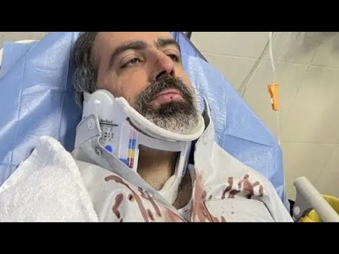 حادث مروعة للفنان الكويتي عبدالله التركماني