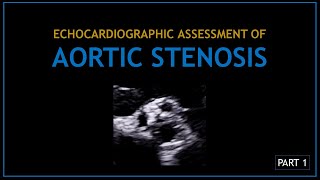 AORTIC STENOSIS (Echocardiographic assessment)  PART 1