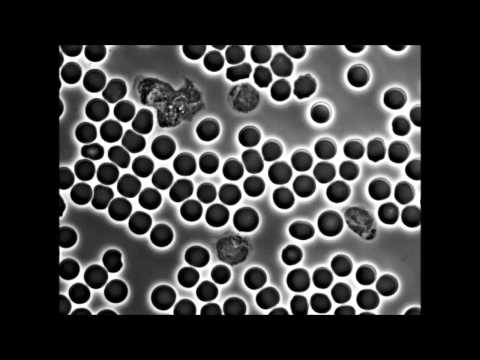 Video: LRRK2 Vid Gränssnittet Mellan Autofagosomer, Endosomer Och Lysosomer