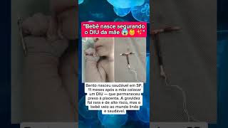 Bebê Nasceu Segurando O Diu Da Mãe