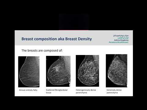 Screening Mammogram: Understanding your Mammogram Report