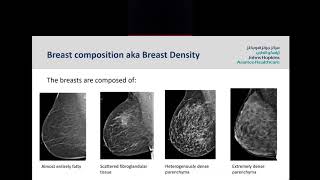 Screening Mammogram: Understanding your Mammogram Report