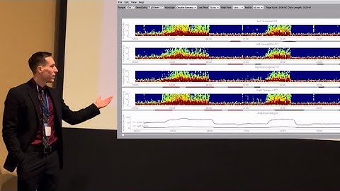 Introduction to QEEG