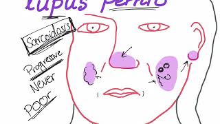 Lupus pernio