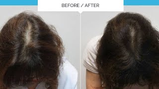 How to control hair fall and frizzy hair at home