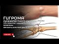 Гигрома лучезапястного сустава