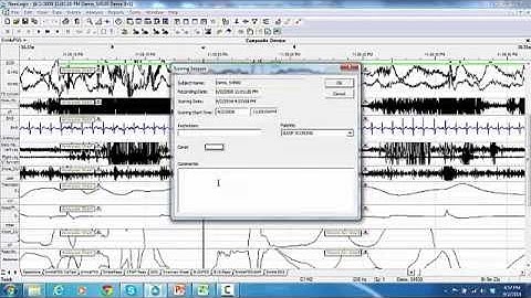 22. RemLogic Manual Scoring for Sleep Stages and Arousals