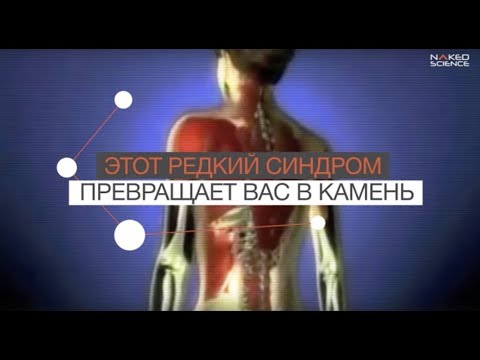 Видео: Настоящи модели на грижа за нарушения на сексуалното развитие - резултат от международно проучване на специализирани центрове