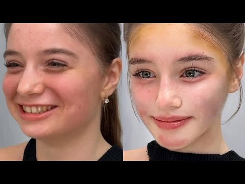 Instant Facial Sculpting Procedure 9D Facial Correction Reconstruction Exp ୨୧ 