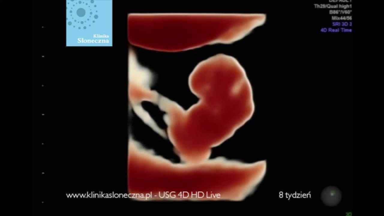 Usg 4d Hd Live 8 Tydzien Ciazy Www Klinikasloneczna Pl Poznan Youtube