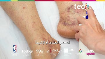 القصور الوريدي المزمن: الإدارة السريرية ❘ TECH Global University