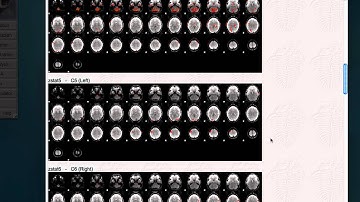 FSL Tutorial 3: FEAT Output