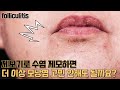 모낭염을 없애기 위한 여정(제모기, 로아큐탄, 면도기, 제모크림, 로션)