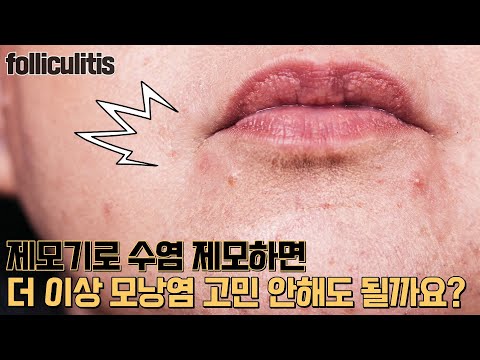 모낭염을 없애기 위한 여정(제모기, <strong>로아큐탄</strong>, 면도기, 제모크림, 로션)