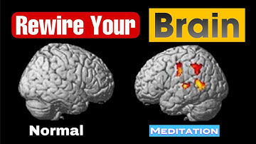 The Science of Meditation: How It Rewires Your Brain & Transforms Your Body | MedGroww
