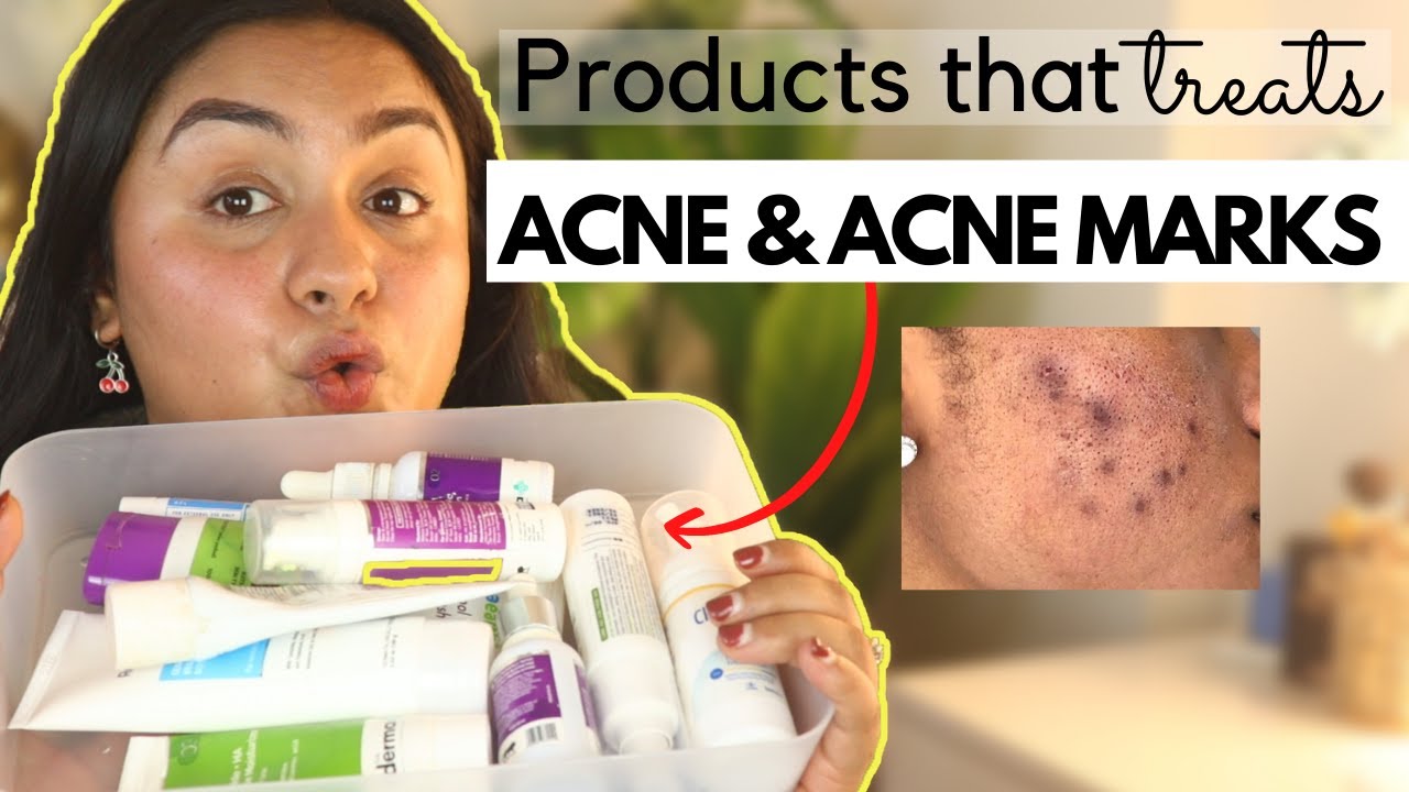 Top Products That will REDUCE ACNE & ACNE MARKS FOREVER! Steps By Step
