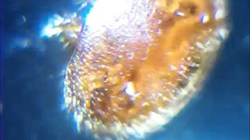 Live varroa under the microscope