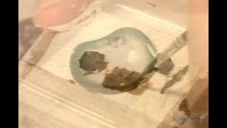 Artificial eyes - How its made