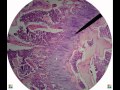 Bone tissue histology.avi