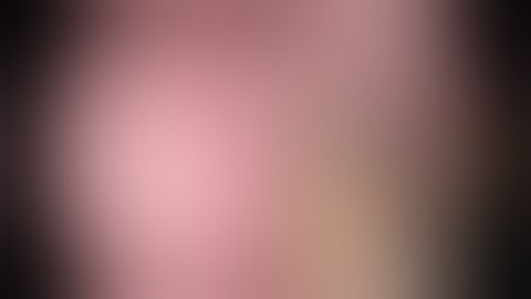 single port VATS right S5 segmentectomy