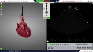 Initial Start Up - HeartWorks Module 9