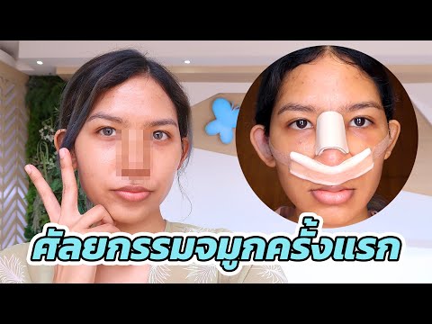 ทำจมูกครั้งแรกในชีวิต จะออกมาปังบ่น้อ? โอ้ย ลุ้นนนน Knack Chira