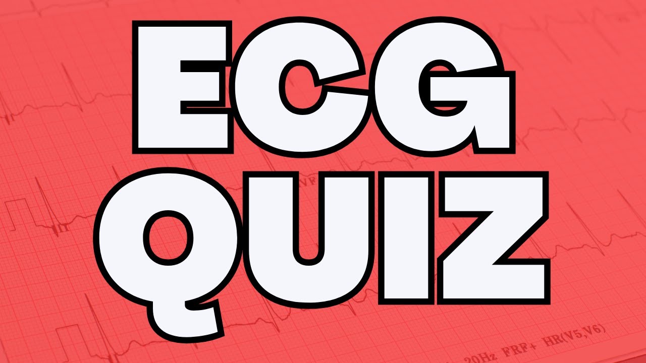 ECG Quiz Collection - YouTube