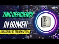 Zinc DEFICIENCY SYMPTOMS || Top 10 Deficiency Symptoms of Zinc in Human Body #zinc #zincdeficiency