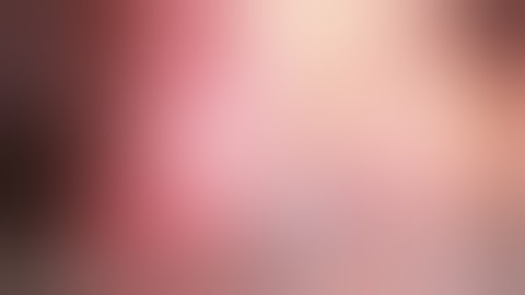 Robotic Radical Prostatectomy - STEP 5-  Bladder Neck Transection