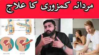 Mardana Kamzori Ka Elaaj | Treatment of Erectile Dysfunction by Dr.Mohsin