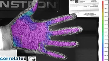 Human Hand Strain - DIC