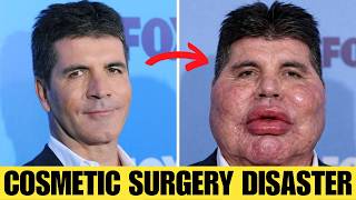 Famous 15 Shocking Male Plastic Surgery Transformations! | Then and Now 2026 Profile