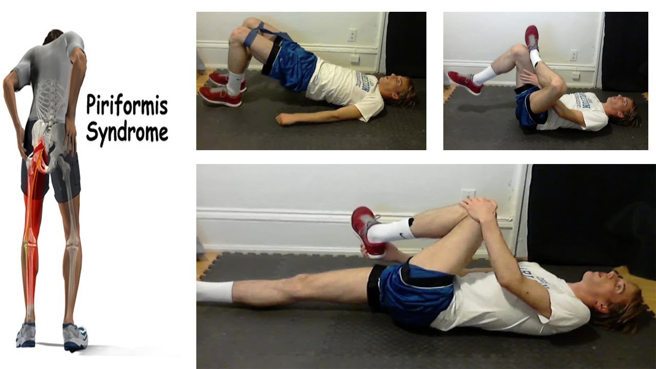 Piriformis Syndrome What is it and How to Treat? Piriformis