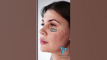 Before & After - The Power of Consistent Branding